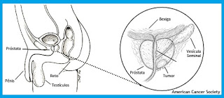 novembro-azul-cancer-de-prostata-definicao-de-prostata